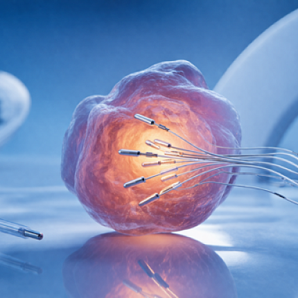 Брахитерапия: что это такое и кому подходит метод точечного облучения